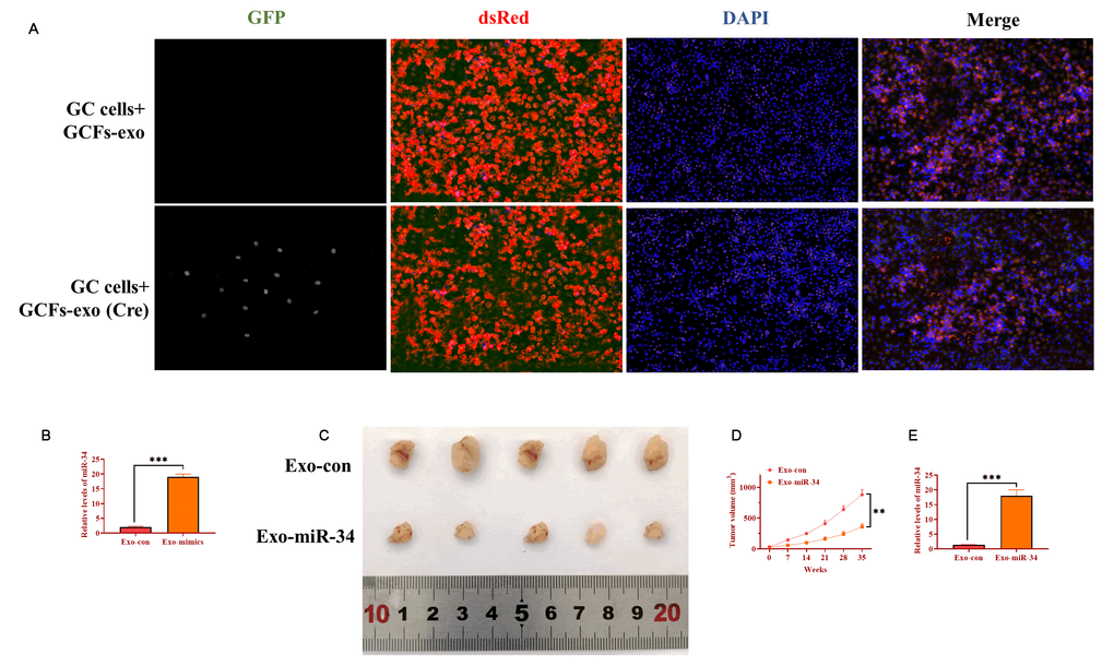 Exosomal miRNA-34 inhibits tumor growth of GC cells in vivo. (A) Exosomes derived from GCFs labeled with Cre could be taken up by GC cells of tumor tissue. Scale bars: 50 μm. (B) The expression of miRNA-34 in exosomes transfected with miRNA-34 mimics. (C) Representative image of excised xenograft tumors. (D) Tumor growth curve. (E) The expression of miRNA-34 in tumor tissues treated with exosomes loaded with miRNA-34 mimics.