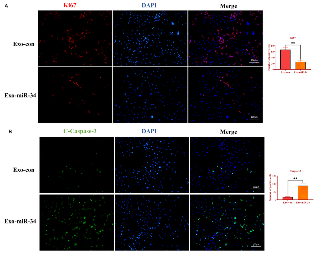 Exosomal miRNA-34 promotes apoptosis of GC cells in vivo. (A) Immunostaining assay for Ki67 in xenograft tumors treated with exosomes loaded with miRNA-34 mimics. (B) Immunostaining assay for cleaved-caspase-3 in xenograft tumors treated with exosomes loaded with miRNA-34 mimics. Values are means ± SD; **, P P 