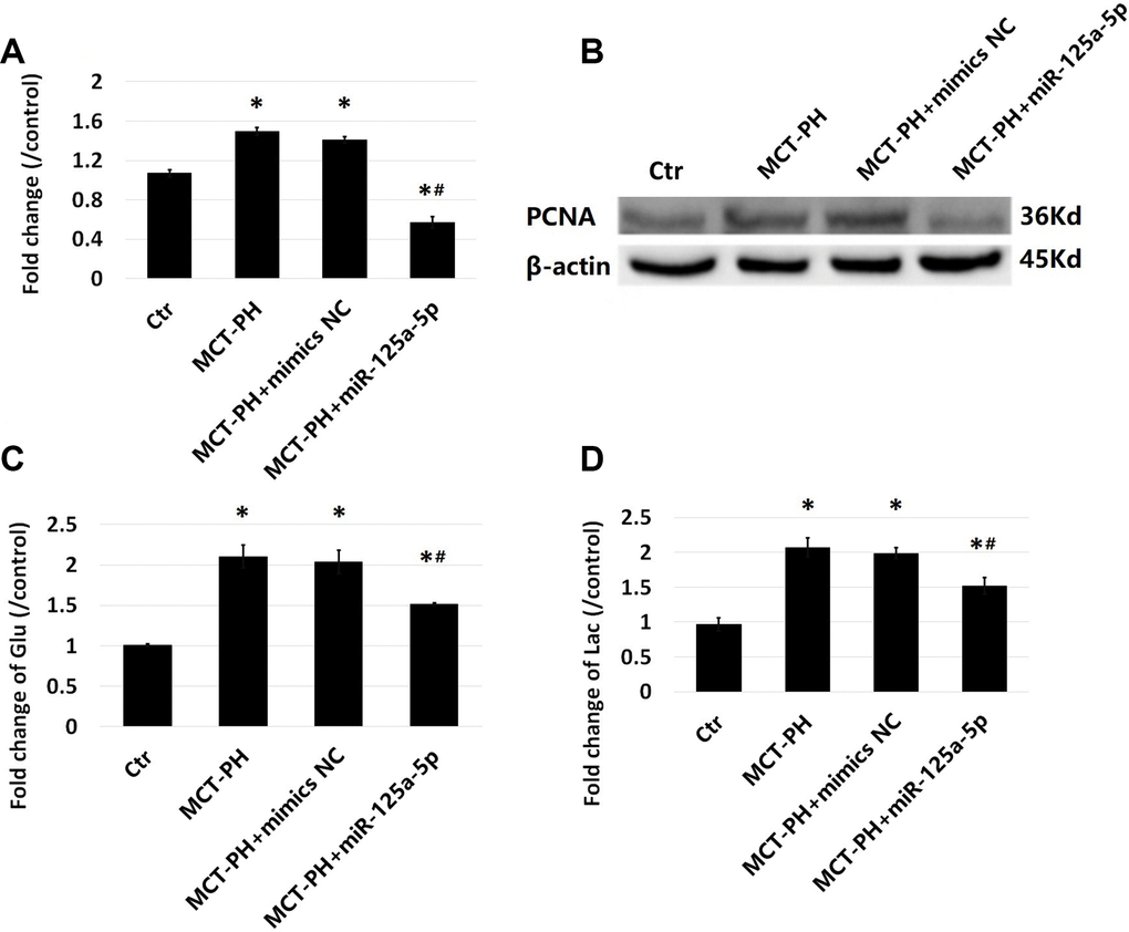 Effect of miR-125a-5p on PASMCS proliferation. Cell proliferation levels were determined by CCK-8 kit (A) and proliferating cell nuclear antigen (PCNA) (B). Glucose consumption (C) and lactic acid content (D) were measured by assay kits. (*P