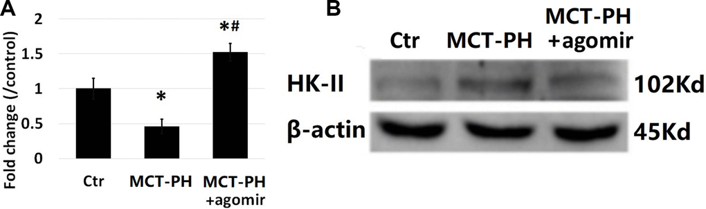 Detection of pulmonary vascular miR-125a-5p and HK-II expression. (A) RT-PCR assay showed that the expression of miR-125a-5p in PASMCs was significantly lower in PH group. The level of miR-125a-5p expression in PH+ agomir group was higher than that in PH group. (B) WB results showed that the expression of HK-II was significantly increased in the PH group, thus demonstrating that miR-125a-5p negatively regulates the expression of HK-II in PASMCs. (*P