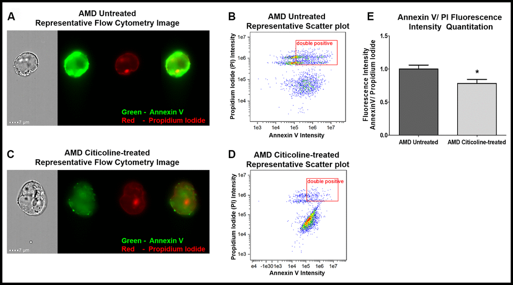 (A) AMD Untreated cells’ Representative Annexin V/ PI staining flow cytometry image; (B) AMD Untreated cells’ Representative Annexin V/ PI fluorescence intensity scatter plot; (C) AMD Citicoline-treated cells’ Representative Annexin V/ PI staining flow cytometry image; (D) AMD Citicoline-treated cells’ Representative Annexin V/ PI fluorescence intensity scatter plot; (E) AMD Untreated vs. AMD Citicoline-treated Annexin V/ PI fluorescence intensity quantitation.