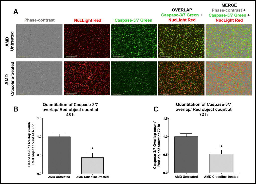 (A) Upper and lower panels show Representative Incucyte live-cell images of untreated and Citicoline-treated AMD cells ,respectively, in phase-contrast (first column), stained with NucLight Red (second column), stained with Caspase-3/7 Green (third column), overlap i.e., Caspase-3/7 + NucLight (fourth column), and Merge i.e., Phase-contrast + Caspase-3/7 + NucLight (fifth column). Scale bar = 400 μM.(B) Quantitation of Caspase-3/7 overlap/ Red object count at the 48 h time point. (C) Quantitation of Caspase-3/7 overlap/ Red object count at the 72 h time point.