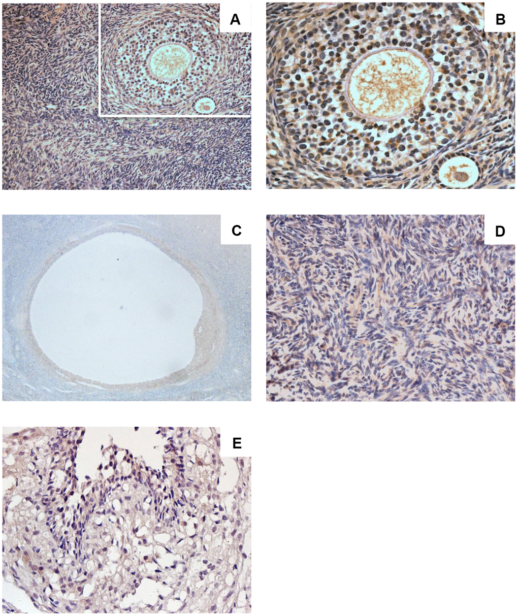 Sigma-1 Receptor Expression in Ovary Tissue. Ovarian cortex in women of childbearing age (A, ×200) (C, ×400) showed intense immunostaining. Intense immunostaining was observed inovarian granulosa cells and theca cells of growing follicle (B, ×400). Granulosa cells of mature follicle also showed intense staining (D, ×200). Low immunostaining was observed in human ovarian stromal cells (E, ×400).