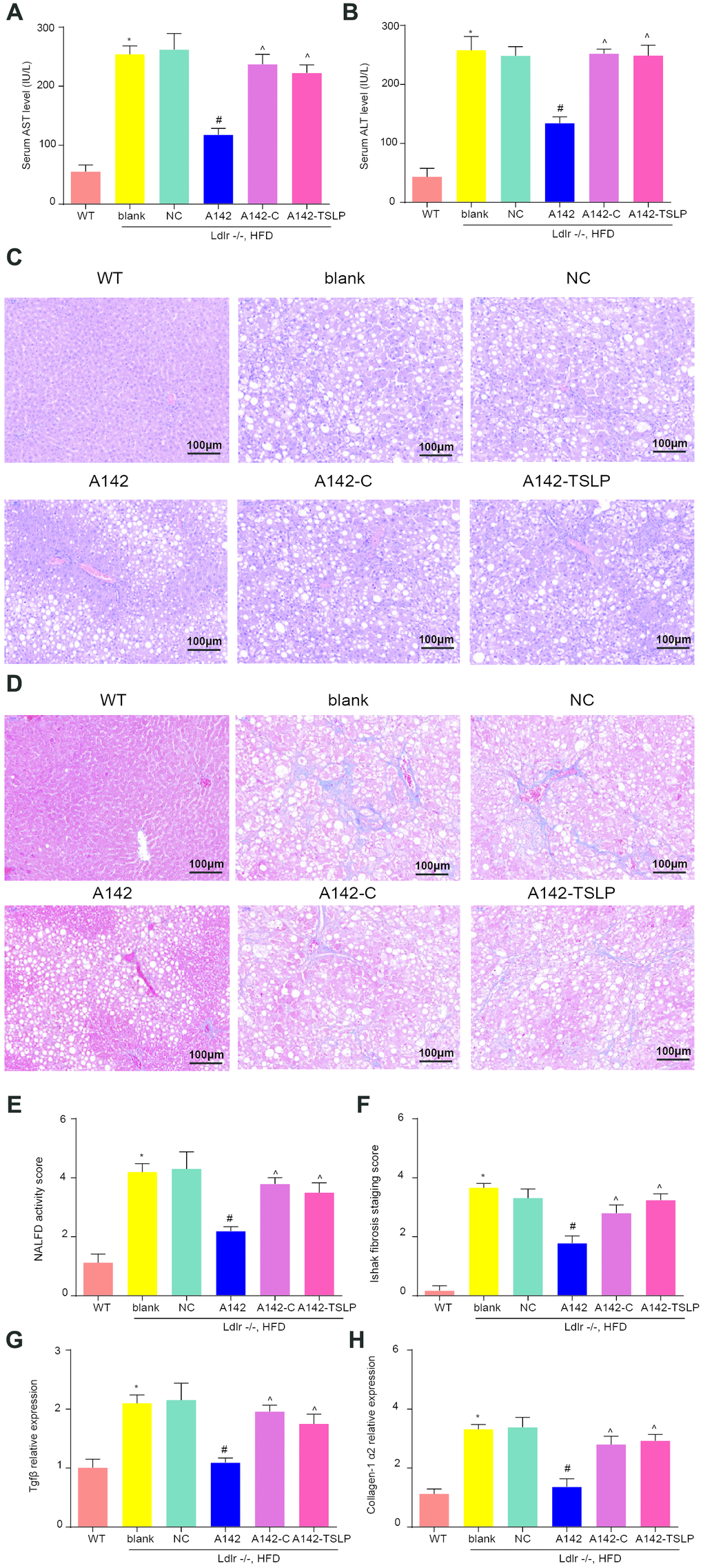 miR-142-5p reduced liver injury, liver fatty degeneration and liver fibrosis, which could be rescued by JAK-STAT signaling pathway activator or AAV/TSLP. (A) The level of alanine aminotransferase (ALT) secreted into serum. (B) The level of aspartate aminotransferase (AST) secreted into serum. (C, E) H&E staining for liver fatty degeneration. Original magnification ×200. (D, F) The representative images of collagen deposition in Masson’s trichrome. The expression of fibrosis-related genes. Original magnification ×200. (G) The mRNA expression level of Tgfβ and (H) The mRNA expression level of Collagen-1 α2. *P #P ^P 