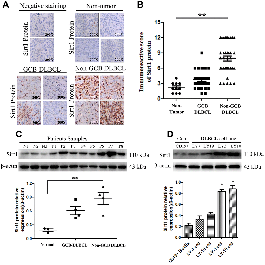 Sirt1 protein is overexpression in DLBCL patients, especially in Non-GCB DLBCL tissues. (A) Immunohistochemistry (IHC) staining indicates that Sirt1 protein expression is upregulated in DLBCL patients, compared with that of normal lymph nodes (non-tumor). A representative sample (GCB-DLBCL: 36; Non-GCB DLBCL: 38; Normal: 10) is shown (200 ×). (B) Scatter diagrams of Sirt1 protein expression in DLBCL patients indicated using immunoreactive scores. (C) Western blotting analysis of Sirt1 expression in three normal lymph node (non-tumor), four primary GCB-DLBC tissues (p1, p2, p3 and p4) and four primary Non-GCB DLBCL tissues (p5, p6, p7 and p8). (D) Western blotting was used to detect Sirt1 expression in CD19+ purified peripheral blood from normal B cells, GCB-DLBCL cell lines (LY7 and LY19 cells), Non-GCB DLBCL cell lines (LY3 and LY10 cells) and normal lymph nodes (non-tumor); Each sample was normalized to β-actin expression. All experiments were performed in triplicate. * indicates p