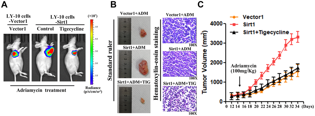 The mitochondrial pathway is required for Sirt1-induced chemoresistance in vivo. (A) Mice were treated with Adriamycin (100 mg/kg), twice a week, and tigecycline (100 mg/kg), once a day. After 4 weeks of treatment tumor growth was observed through live imaging and representative images of the tumors in each group of mice. (B, C) Tumors from all mice in the indicate cell together with the mean tumor volumes. Hematoxylin-eosin staining method was used to observe microscopic images of tumor cells. A representative sample (Vector1: 4; Sirt1: 4; Vector2: 4; Si-sirt1: 4) is shown (200 ×). (C) Tumor volumes were measured on the days indicated. All experiments were performed in triplicate. * p