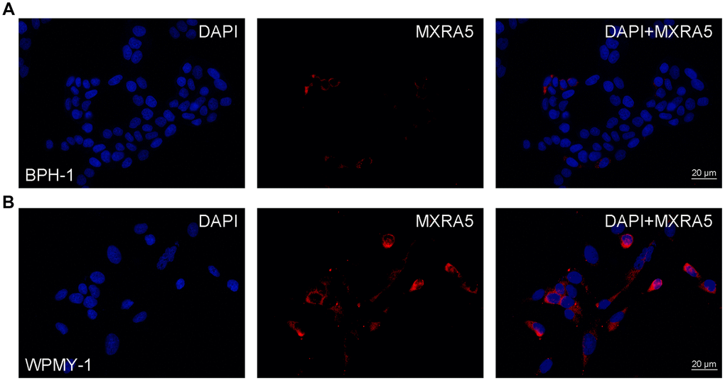 Immunofluorescence of MXRA5 in human prostate cells. (A) Human epithelial cells (BPH-1). Left: DAPI (blue) indicates nuclear staining. Middle: Cy3-immunofluorescence (red) indicates the MXRA5 protein which was rarely observed in the epithelial cells. Right: Merged image. The scale bar is 20 μm. (B) Human stromal cells (WPMY-1). Left: DAPI (blue) indicates nuclear staining. Middle: Cy3-immunofluorescence (red) indicates the MXRA5 protein which was abundantly observed in the stromal cells. Right: Merged image. The scale bar is 20 μm. Representative graphs of prostate cells were selected into figure.