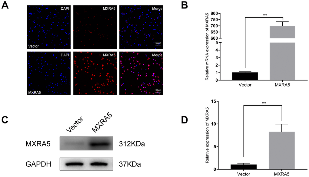 Prostate cell lines with overexpression of MXRA5. (A) Immunofluorescence staining of MXRA5 protein (red) in the BPH-1 cells after treatment with MXRA5-plasmid, compared with vector-control treatment. Nuclei were stained by DAPI (blue). Three repeats of experiments for were conducted and representative graphs were selected into figure. The scale bar is 100 μm. (B) qRT-PCR validated the efficiency of MXRA5 overexpression at transcriptional level in BPH-1 cells. All values shown are mean ± SD of triplicate measurements and repeated three times with similar results, ** means PC) Western blot analysis revealed an increased protein expression of MXRA5 by the MXRA5 plasmid treatment, compared to vector-control treatment. (D) Relative densitometric quantification of MXRA5 in BPH-1 cells. GAPDH expression was analyzed as a loading control, results are expressed as the ratio of the proteins with respect to GAPDH. ** means P