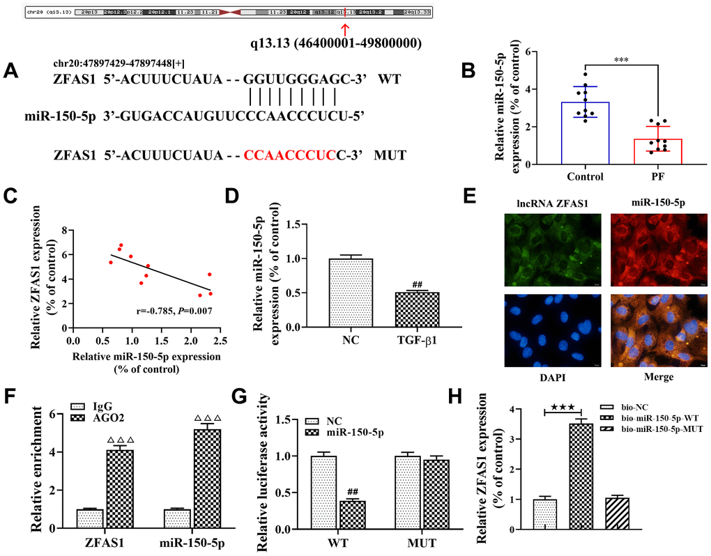 lncRNA ZFAS1 interacts with and negatively regulates miR-150-5p. (A) Sequence alignment of lncRNA ZFAS1 with the binding sites in miR-150-5p; (B) The expression of miR-150-5p in lung tissues was analyzed by RT-qPCR; (C) Spearman correlation was used to analyze the association between miR-150-5p and lncRNA ZFAS1 expression in the lung tissues of BLM-induced pulmonary fibrosis; (D) RT-qPCR was used to detect the expression of miR-150-5p in HFL1 cells; (E) FISH was performed to evaluate the location of endogenous lncRNA ZFAS1 and miR-150-5p in HFL1 cells; (F) RT-qPCR was applied to detect the expression of lncRNA ZFAS1 and miR-150-5p in AGO2 pellet; (G) dual-luciferase reporter gene was used to verify the targeted relationship between lncRNA ZFAS1 and miR-150-5p; (H) RNA pulldown assay showed that biotin labeled miR-150-5p-WT interacted with lncRNA ZFAS1. ***P##PΔΔΔP★★★P