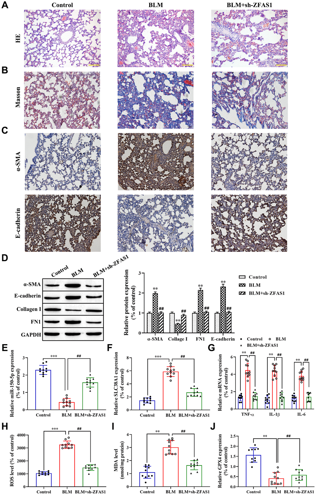 Knockdown of lncRNA ZFAS1 blocks BLM-induced PF via regulation of the miR-150-5p/SLC38A1 axis. (A, B) HE and Masson staining were used to observe the morphological changes of lung tissues; (C, D) Immunohistochemistry assay was performed to detect the expression of E-cadherin and α-SMA in lung tissues; (D) Western blot was performed to measure the expression of E-cadherin, collagen I, FN1 and α-SMA in lung tissues; (E–G) The expression of miR-150-5p, SLC38A1, inflammatory cytokines in lung tissues were determined by RT-qPCR; (H) the level of ROS was measured by ROS kit; (I) The MDA content was measured by lipid peroxidation (MDA) assay kit; (J) RT-qPCR was performed to detect the level of GPX4 mRNA. **P***P##P