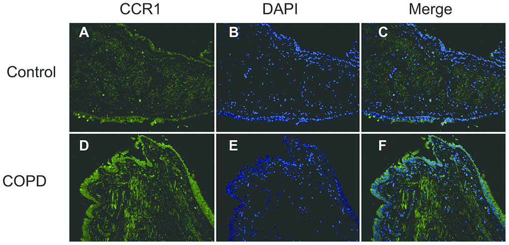 Immunofluorescence of CCR1 in the bronchial mucosa of patients with COPD and control. Representative CCR1 expression (green fluorescence) in sections from control (A–C) and COPD (D–F).
