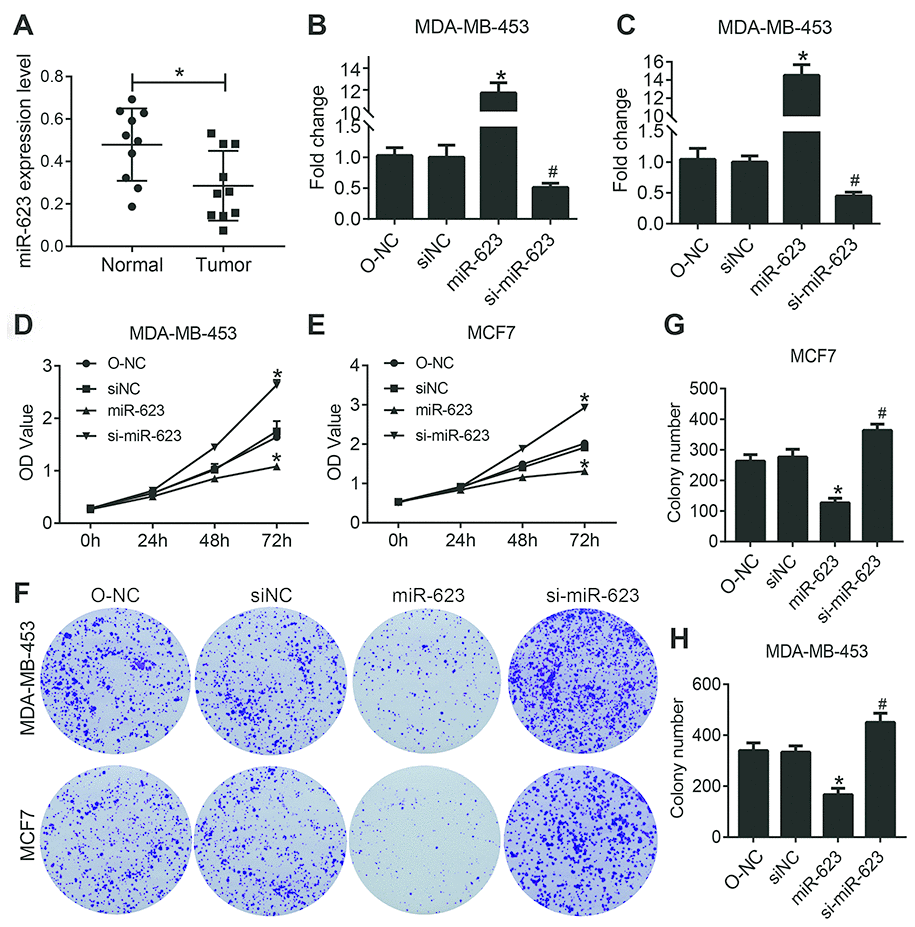 miR-623 inhibited cell growth. (A) Expression levels of miR-623 were detected in human normal mammary cell line MCF-10A and breast cancer cell lines BT474, MDA-MB-231, MDA-MB-453 and MCF-7 by real-time PCR. MiR-623 expression in MDA-MB-453 cells (B) and MCF7 cells (C) was determined by real-time PCR after transfection. Cell proliferation of MDA-MB-453 (D) and MCF7 (E) after the suppression or overexpression of miR-623 was evaluated by CCK-8 assay. (F–H) Colony formation assay of MDA-MB-453 and MCF7 cells showed that miR-623 knockdown inhibited the proliferation, whereas miR-623overexpression promoted the proliferation in breast cancer cell lines. One of the three repeated experiments with identical results was shown. P values were determined using Student’s t-tests. *PP