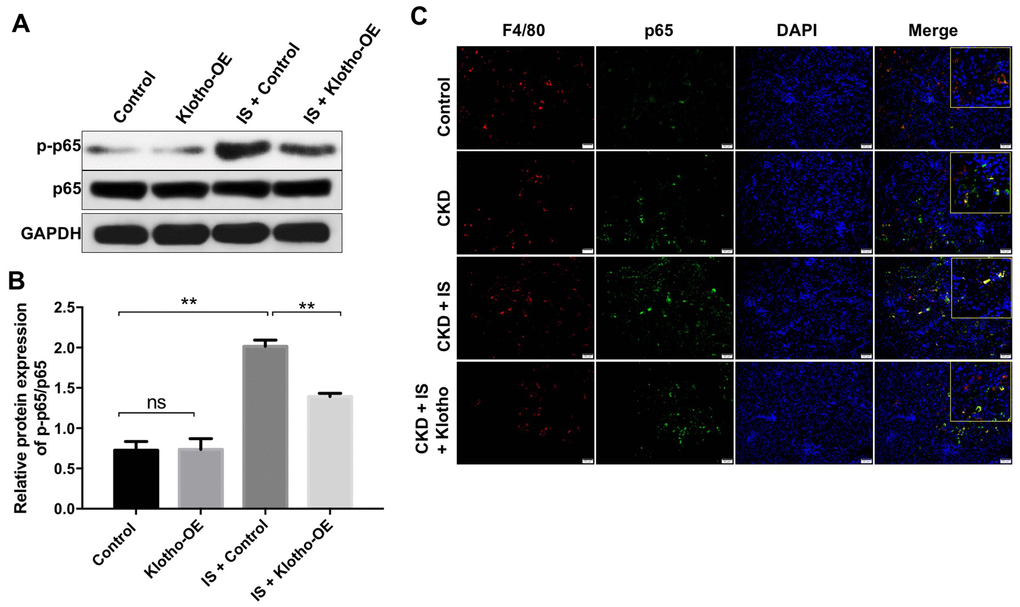 Overexpression of Klotho alleviates IS-induced heart failure and kidney damage in vitro and in vivo by activating the NF-kB pathway. (A) THP-1 cells were exposed to PMA (160 nM) for 48 h, incubated in PMA-free medium for 24 h, and then transfected with the Klotho expression plasmid for 24 h. The expression of p-p65 in cells was evaluated by western blotting. (B) The relative expression of p-p65 was evaluated normalized to p65. (C) Quantification of relative expression based on F4/80, p65 and DAPI staining in mouse kidney tissue. **P 