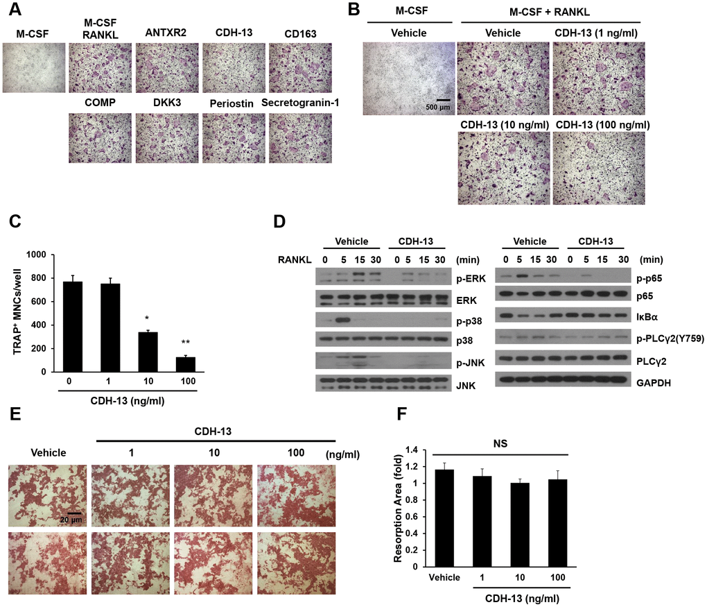 Effects of CDH-13 on RANKL-induced osteoclast differentiation. (A) BMMs were cultured for three days in the presence of M-CSF (30 ng/mL) and RANKL (100 ng/mL) with one of the candidate proteins (ANTXR2, CDH-13, CD163, COMP, DKK3, periostin or secretogranin-1; 100 ng/mL). Osteoclasts were stained with TRAP. (B) BMMs were incubated with various concentrations of CDH-13 (0, 1, 10 and 100 ng/mL). (C) TRAP-positive multinucleated cells with more than five nuclei were counted. (D) M-CSF-treated BMMs were pretreated with CDH-13 or the vehicle for 30 min. RANKL (100 ng/mL) was used to stimulate the cells at the indicated times, and immunoblotting was used to detect members of the RANKL/mitogen-activated protein kinase and NF-κB signaling pathways. (E, F) Differentiated osteoclasts were cultured in the presence of the vehicle or CDH-13 (1, 10 or 100 ng/mL) on dentin slices. Resorption pits were visualized with hematoxylin, and the resorption areas were measured. Error bars represent ± SEM. ** PP 