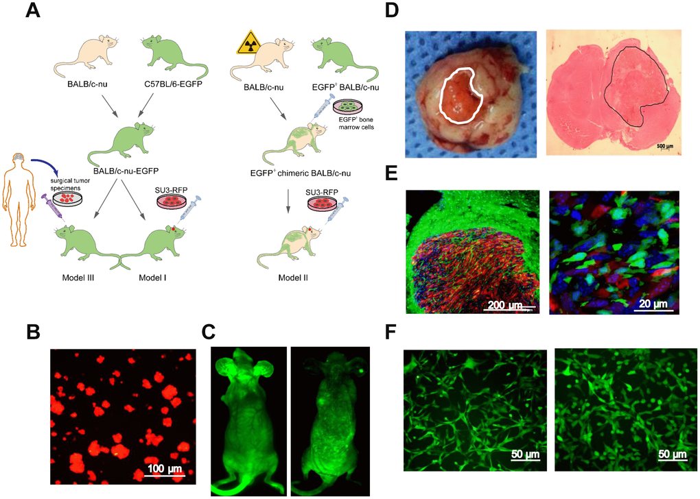 Intracerebral xenografting of GSCs. (A) Schematic overview of the establishment of the dual-color fluorescence-tracing intracranial GSC-MSC interaction model; (B) SU3-RFP cells; (C) Transgenic EGFP+ nude mouse, and chimeric nude mice with autologous bone marrow deprivation and exogenous EGFP+ bone marrow cell transplantation; (D) Transplanted tumor observed under natural light, and H&E staining of a transplanted tumor section; (E) Transplanted tumor from an EGFP+ nude mouse under a fluorescence microscope; (F) Monocloned EGFP+ cells with high proliferative capacities, TMEC1, TMEC2. Scale bars: (A) 100 μm; (C) 500 μm; (D) 200 μm; (F) 50 μm.