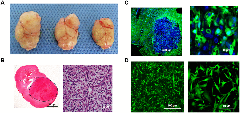 Intracerebral-xenograft-derived glioblastoma specimens. (A) Whole brain of a tumor-bearing mouse; (B) H&E staining; (C) Transplanted tumor viewed under a fluorescence microscope; (D) Monocloned EGFP+ TMEC3 cells. Scale bars: (B) 500 μm (left), 20 μm (right); (C) 10 μm; (D) 100 μm (left), 50 μm (right).