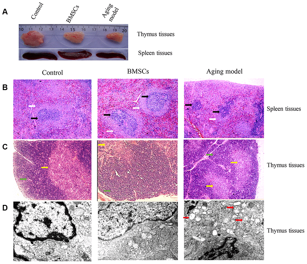 BMSCs improved the morphological changes of thymus and spleen tissues of aging rats. (A) Morphological changes of thymus and spleen tissues were observed through naked eyes; (B) Histological changes of spleen tissue were investigated after HE staining; (C) Histological changes of thymus tissue were investigated after HE staining; (D) Histological changes of thymus tissue was investigated using transmission electron microscopy. White arrows indicate white pulp; Black arrows indicate splenic nodule; Green arrows indicate cortex; Yellow arrows indicate medulla; Red arrows indicate vacuoles in the cytoplasm of epithelial reticular cells.