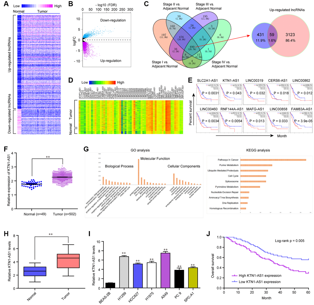 KTN1-AS1 was up-regulated in NSCLC. (A) Heatmap of differentially express (DE) lncRNAs using TCGA data analysis. (B) Volcano plots show differentially expressed lncRNAs based on the TCGA datasets. (C) Venn diagram of altered lncRNAs in TCGA datasets and the data from Cancer RNA-seq Nexus program. (D) The heatmap of the 59 lncRNAs expression which was analyzed above based on the TCGA datasets. (E) Overall survivals of several lncRNAs for NSCLC patients were analyzed by “GEPIA”. (F) Relative expression of KTN1-AS1 using TCGA data analysis. (G) GO and KEGG analysis for the preliminary exploration of KTN1-AS1 function. (H) qPCR analyzed the expression of KTN1-AS1 in our cohort. (I) Relative KTN1-AS1 levels in six NSCLC cells and BEAS-2B cells. (J) Kaplan-Meier survival analysis of NSCLC patients’ overall survival based on KTN1-AS1 expression in our cohort (n = 127). * P 