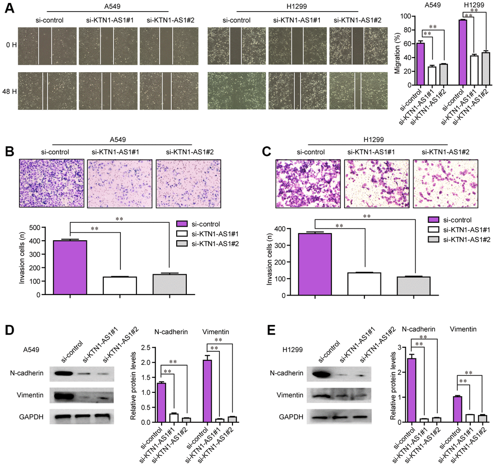 The migration and invasion of NSCLC cells were regulated by KTN1-AS1. (A) Cell migratory capabilities were assessed by wound healing assay after knocking down KTN1-AS1 in A549 and H1299 cells. (B, C) Cell invasive capabilities were examined by transwell assay after the knockdown of KTN1-AS1 A549 and H1299 cells. (D, E) western blot analyzed the protein levels of N-cadherin and vimentin. * P 