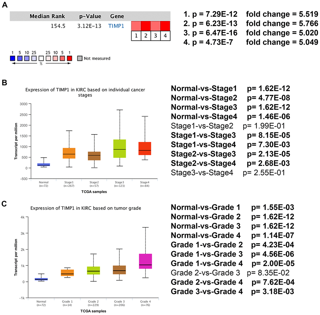 Transcriptional expression of TIMP1 significantly correlated with advanced clinicopathological parameters and poor survival outcomes in ccRCC patients. (A) Oncomine analysis of cancer vs. normal tissue of TIMP1. Heat maps of TIMP1 gene expression in clinical hepatocellular carcinoma samples vs. normal tissues. 1. Clear Cell Renal Cell Carcinoma vs. Normal, Higgins, Am J Pathol, 2003 [49]. 2. Clear Cell Renal Cell Carcinoma vs. Normal, Yusenko, BMC Cancer, 2009 [50]. 3. Clear Cell Renal Cell Carcinoma vs. Normal, Jones J, Clin Cancer Res, 2005 [51]. 4. Clear Cell Renal Cell Carcinoma vs. Normal, Gumz ML, Clin Cancer Res, 2007 [52]. (B) Transcriptional expression of TIMP1 was significantly correlated with AJCC stage, patients who were in a more advanced stage tended to express higher mRNA expression of TIMP1. (C) Transcriptional expression of TIMP1 was significantly correlated with ISUP grade. Patients in a more advanced grade tended to exhibit elevated TIMP1mRNA expression. Abbreviations: ccRCC: clear cell renal cell carcinoma.