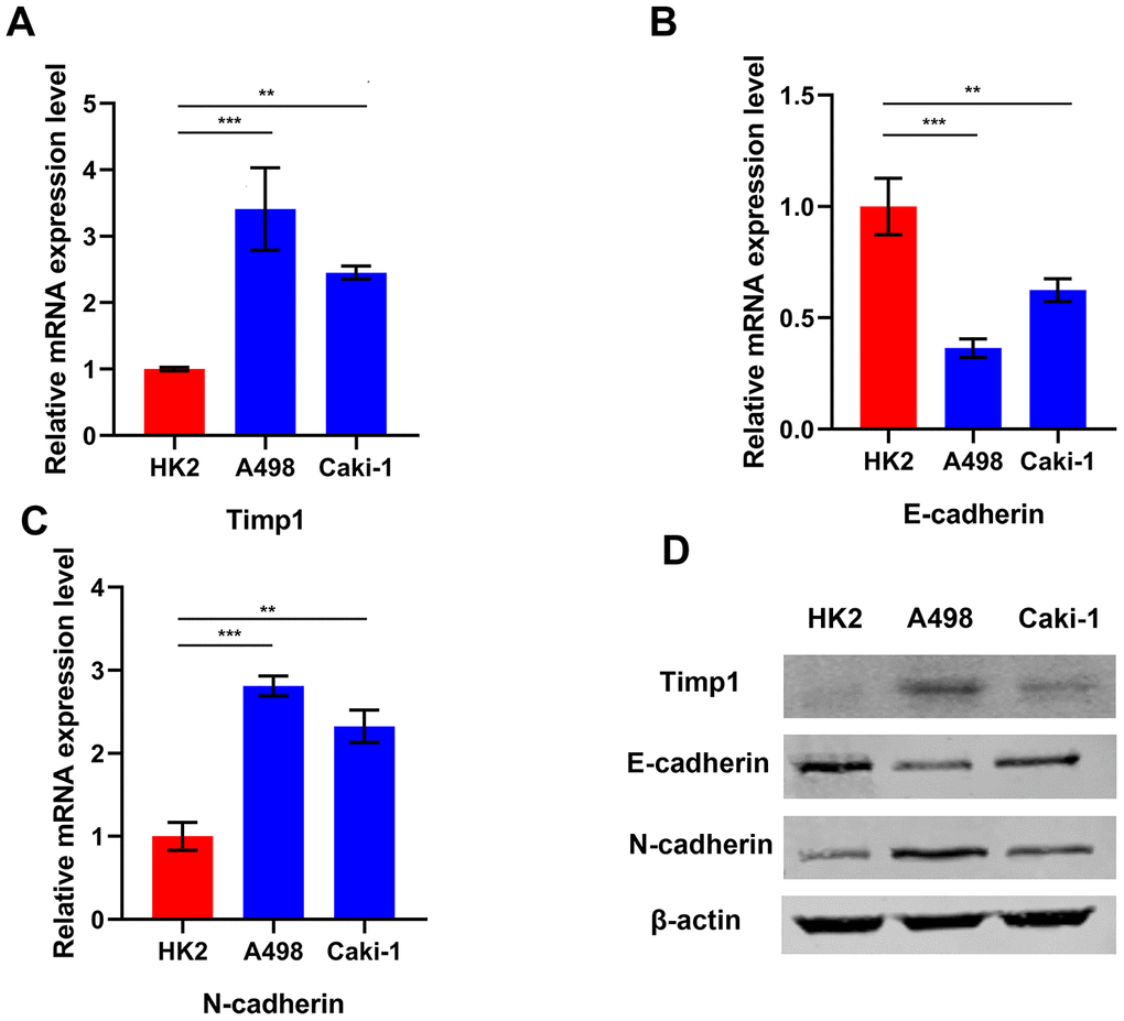TIMP1 expression was associated with mesenchymal phenotype in ccRCC cell lines. Relative mRNA expression of TIMP1 (A), E-cadherin (B) and N-cadherin (C) in 2 ccRCC cell lines and a normal cell line presented separately as histograms. (D) TIMP1, E-cadherin, and N-cadherin protein levels as determined by Western blot analysis. β-actin was used as the internal control. (* p
