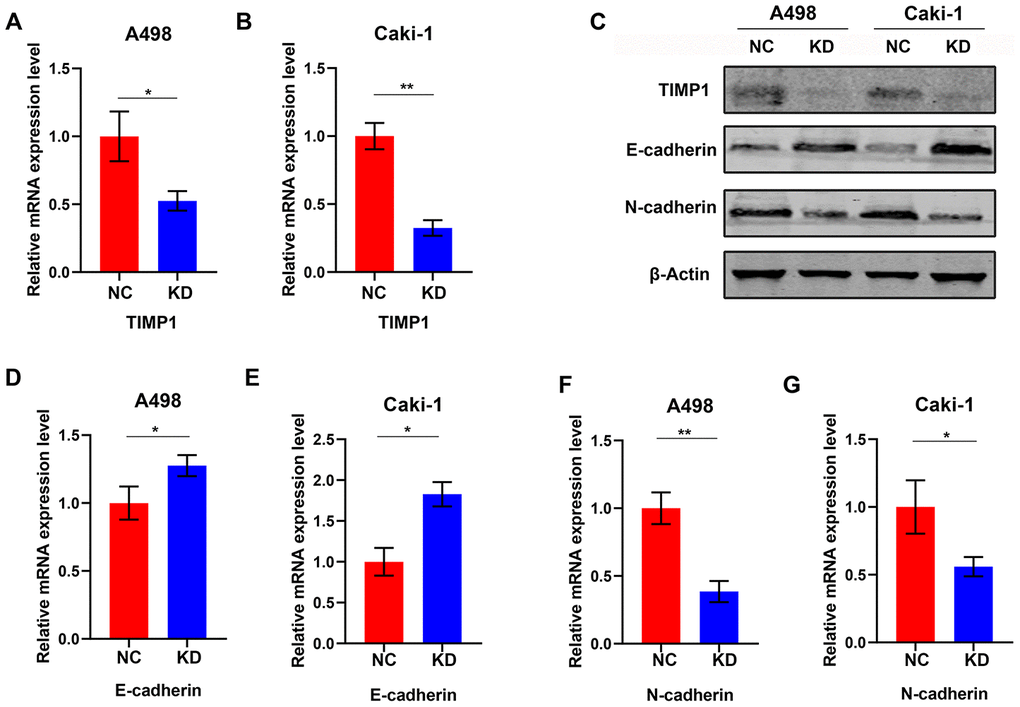 Knockdown of TIMP1 induced MET in A498 and Caki-1 cells. qRT-PCR (A, B) analysis of TIMP1 expression in A498 and Caki-1 cells transfected with TIMP1 shRNA (KD) and normal controls (NC). (C) Western blot analysis of TIMP1 expression in A498 and Caki-1 cells transfected with TIMP1 shRNA (KD) from a normal control (NC). Expression levels of protein (C) and mRNA (D–G) of the EMT markers are shown. (* p