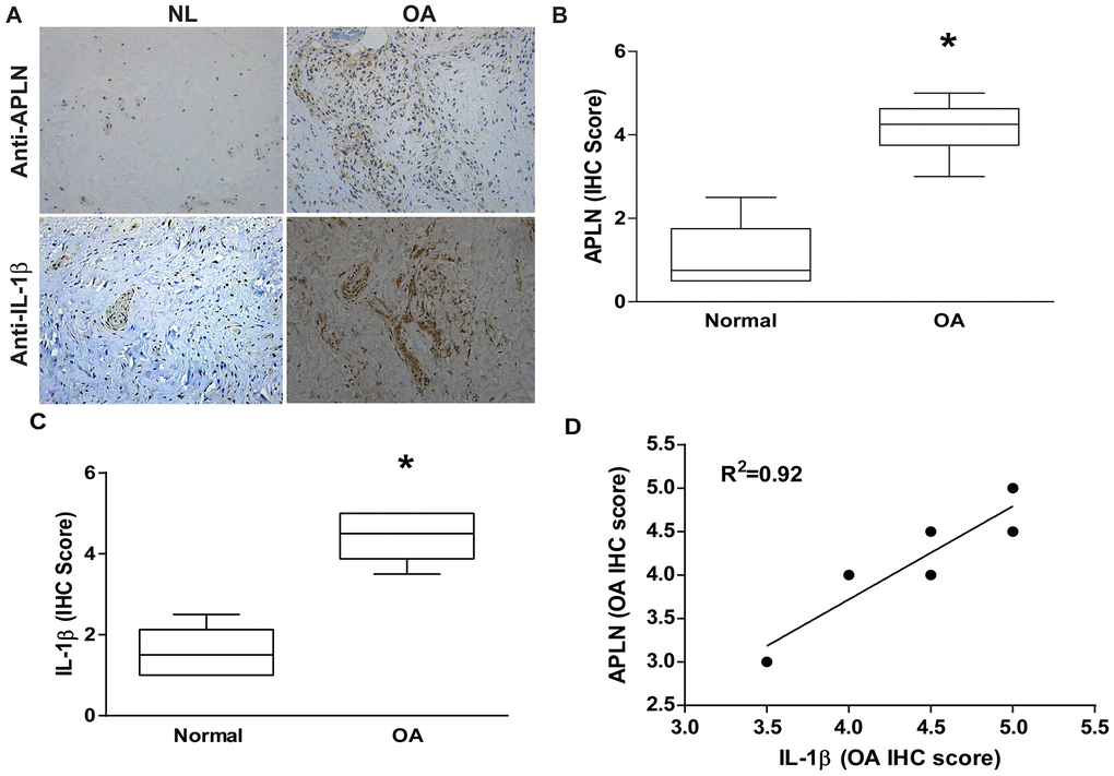 APLN expression is positively correlated with IL-1β expression in OA patients. (A) IHC staining showing increased levels of APLN and IL-1β expression in OA synovial tissue (n=8) compared to normal healthy tissue (n=5). (B, C) The IHC score of APLN and IL-1β are presented. (D) Correlation between levels of APLN and IL-1β expression in synovial tissues retrieved from OA patients.