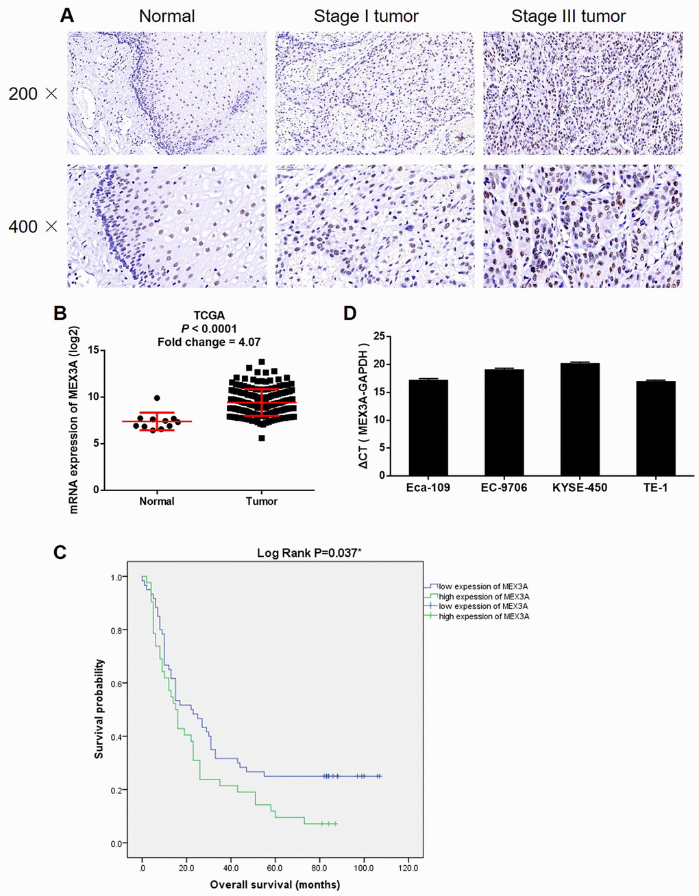 MEX3A was upregulated in ESCC. (A) The expression of MEX3A in ESCC tumor tissues and normal tissues was detected by IHC. (B) The expression profiling data collected from TCGA showed that MEX3A was upregulated in ESCC. (C) Kaplan-Meier survival analysis was performed to reveal the relationship between MEX3A expression and prognosis of ESCC patients. (D) The background expression of MEX3A in ESCC cell lines including Eca-109, EC-9706, KYSE-450 and TE-1 was detected b qPCR.