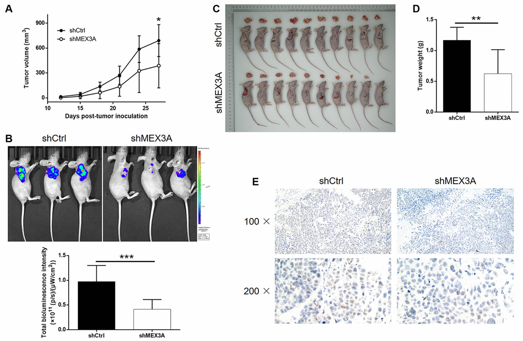 MEX3A knockdown inhibited development of ESCC in vivo. Mice xenograft models were constructed through subcutaneously injecting Eca-109 cells with or without MEX3A knockdown. (A) The volume of tumors on mice was measured and calculated at indicated intervals during the culture of the animal models. (B) In vivo imaging of the tumors on mice was facilitated by the injection of D-luciferin before sacrificing the mice. (C) The photos of the tumors removed from the sacrificed mice were collected by a digital camera. (D) Tumor weight was measured after obtaining the removed tumors from animal models. (E) Tumor sections obtained from the removed tumors were subjected to IHC analysis to detect the expression of Ki-67. The data were expressed as mean ± SD (n ≥ 3), *PPP