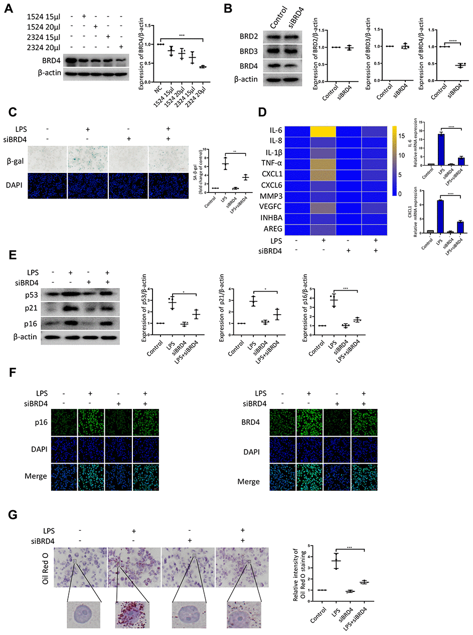 BRD4 is involved in macrophage senescence caused by inflammation. THP-1 macrophages were incubated with four different siRNAs for knockdown of BRD4. (A) BRD4 expression was evaluated by western blotting, as shown in the scatter plot. (B) Western blot analysis for BRD2, BRD3, and BRD4 protein expression. Actin was used for normalization. (C) SA-β-gal activity was analyzed after the knockdown of BRD4. The quantification of SA-β-gal positive cells is presented in the scatter plot. (D) Analysis of SASP genes mRNA levels in THP-1 macrophages. The results are presented in the cluster heatmaps. IL-6 and CXCL1 mRNA levels are shown in the histogram on the right. (E) The senescence markers p53, p21, and p16 were analyzed by western blotting. The results are presented in the scatter plot. Actin was used as the loading control. (F) Immunofluorescence images showing BRD4 (green) and p16 (green). The nuclei were counterstained with DAPI (blue). (G) Representative Oil Red O (ORO) staining and statistical data were used to assess lipid uptake. The data all represent measurement data presented as the mean ± SD. The two groups were statistically analyzed using independent sample t-test. One-way ANOVA was used in comparisons among multiple groups, followed by Tukey’s post-hoc test. Significant differences among the different groups are indicated as *p p p 