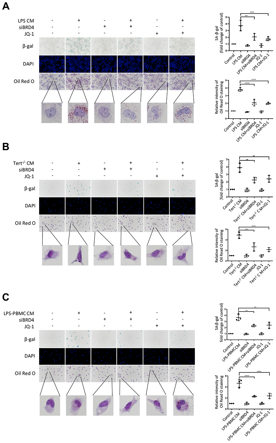BRD4-induced inflammation reinforces the senescent phenotype via paracrine pathways. (A) THP-1 macrophages were cultured with LPS-induced senescent cell-derived conditioned medium for 24 h with or without siBRD4 or the BRD4 inhibitor JQ-1 (1 μM). Representative SA-β-gal was used to detect cell senescence, and Oil Red O staining was used to detect lipid accumulation in the cells. Scale bar, 50 μm. (B, C) The peritoneal macrophages from the Tert-/- mice and human peripheral blood mononuclear cells (PBMCs) were cultured with the corresponding conditioned medium for 24 h. Representative SA-β-gal was used to detect cell senescence, and Oil Red O staining was used to detect lipid accumulation in the cells. Scale bar, 50 μm. The data all represent measured data presented as the mean ± SD. Comparisons between multiple groups were performed using one-way ANOVA, followed by Tukey’s post-hoc test. The experiment was repeated three times. Significant differences among different groups are indicated as **p p -/- CM; ****p 