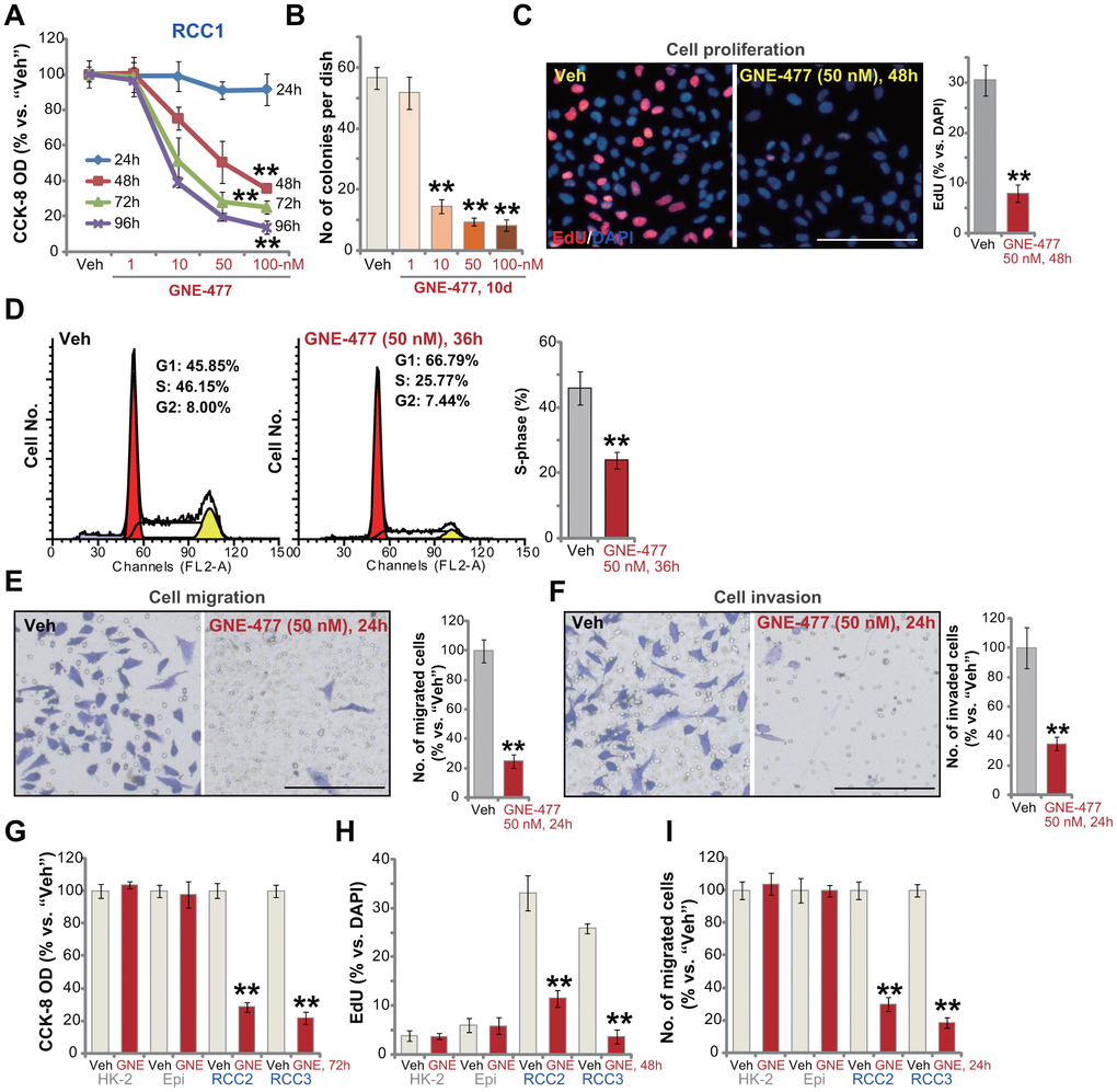 GNE-477 potently inhibits human RCC cell progression in vitro. The primary human RCC cells (“RCC1/RCC2/RCC3”), HK-2 renal epithelial cells (“HK-2”) or the primary human renal epithelial cells (“Epi”) were treated with applied concentration of GNE-477 (1-100 nM) or the vehicle control (“Veh”, 0.1% DMSO), cells were further cultured for the designated time periods (24-96h); Cell viability (A, G), colony formation (B) and proliferation (C, H) as well as cell cycle progression (D), migration (E, I) and invasion (F) were tested by the assays mentioned in the text. Bars stand for mean ± standard deviation (S.D.). For each assay, n=5. ** p vs. “Veh” cells. Experiments in this figure were repeated five times, and similar results obtained. Scale bar= 100 μm (C, E, F).