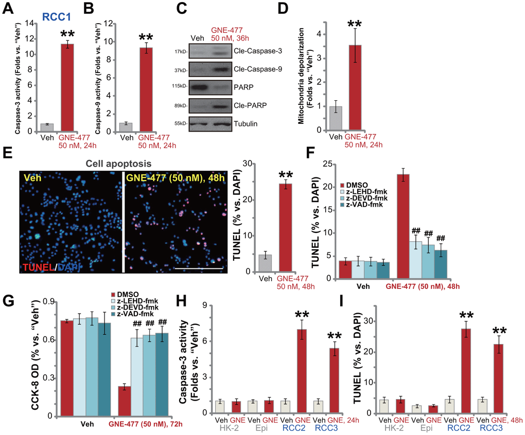 GNE-477 induces apoptosis activation in primary human RCC cells. The primary human RCC cells (“RCC1/RCC2/RCC3”), HK-2 renal epithelial cells (“HK-2”) or the primary human renal epithelial cells (“Epi”) were treated with GNE-477 (50 nM) or the vehicle control (“Veh”, 0.1% DMSO), cells were further cultured for designated time periods (24-48h), and cell apoptosis tested by the mentioned assays (A–E, H, I). Alternatively, RCC1 cells were pretreated for 1h with applied caspase inhibitors (each at 50 μM), followed by GNE-477 (50 nM) stimulation, cells were further cultured for 48-72h, with cell apoptosis and viability examined by nuclear TUNEL staining (F) and CCK-8 (G) assays, respectively. Bars stand for mean ± standard deviation (S.D.). For each assay, n=5. ** p vs. “Veh” cells (A, B, D, E, H, I). ##p vs. “DMSO”-pretreated cells (F, G). Experiments in this figure were repeated five times, and similar results obtained. Scale bar= 200 μm (E).