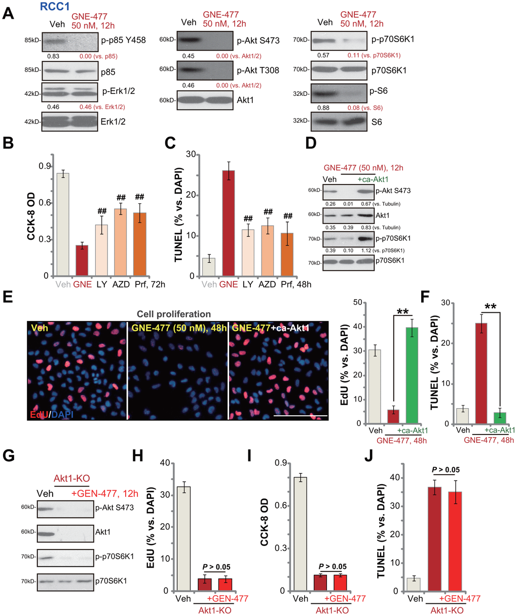 GNE-477 blocks PI3K-Akt-mTOR cascade activation in primary human RCC cells. RCC1 cells were treated with GNE-477 (50 nM) or the vehicle control (“Veh”, 0.1% DMSO), cells were further cultured for 12h, and expression of listed proteins tested by Western blotting (A); RCC1 cells were treated with GNE-477 (“GNE”, 50 nM), LY294002 (100 nM), AZD2014 (“AZD”, 100 nM), perifosine (“Prf”, 1 μM) or the vehicle control (“Veh”, 0.1% DMSO) for 48-72h, with cell viability and apoptosis tested by CCK-8 (B) and nuclear TUNEL staining (C) assays, respectively. The monoclonal stable RCC1 cells with or without the constitutively-active Akt1 (“+ca-Akt1”) construct were treated with GNE-477 (50 nM) or the vehicle control, cells were further cultured for applied time periods, expression of the listed proteins was tested (D); Cell proliferation and apoptosis were tested by EdU staining (E) and TUNEL assay (F), respectively. The monoclonal stable RCC1 cells with the CRISPR/Cas9 Akt1-KO construct (Akt1-KO cells) were treated with or without GNE-477 (50 nM), control cells with empty vector were treated with vehicle control (“Veh”), expression of listed proteins was shown (G); Cell viability, proliferation and apoptosis were tested by CCK-8 (H), EdU incorporation (I), and TUNEL staining (J) assays after 48h, respectively. Expression of listed proteins was quantified, normalized to the loading control (A, D). Bars stand for mean ± standard deviation (S.D.). For each assay, n=5. ##p vs. GNE-477 treatment (B, C). ** p E, F). Experiments in this figure were repeated five times, and similar results obtained. Scale bar= 100 μm (E).