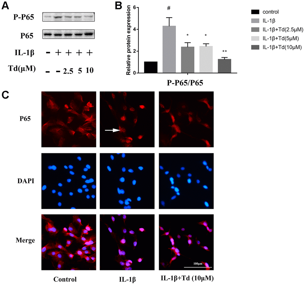 Tomatidine suppresses IL-1β-induced NF-κB activation in primary chondrocytes. (A) Representative western blot images and (B) Histogram plots show the levels of phospho-P65 and P65 proteins relative to GAPDH (internal control) levels in the primary chondrocytes treated for 30 mins with 2.5, 5, or 10μM tomatidine alone or in combination with 10 ng/mlIL-1β. DMSO was used as control. (C) Immunofluorescence staining images show P65 localization in primary chondrocytes treated for 30 mins with 2.5, 5, or 10μM tomatidine alone or in combination with 10ng/mlIL-1β. The white arrow indicates nuclear translocation of P65. The values are shown as means ± SD of triplicate experiments. #p 