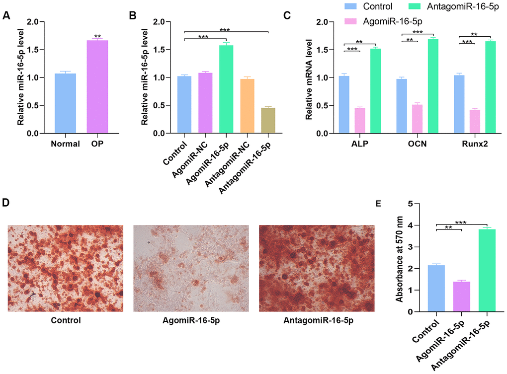 High miR-16-5p levels inhibit osteogenic differentiation in osteoporosis patients and hMSCs. (A) QRT-PCR analysis of miR-16-5p levels in postmenopausal patients with or without osteoporosis (n=10 per group). (B) QRT-PCR analysis of miR-16-5p levels in control hMSCs and hMSCs transfected with agomiR-NC, agomiR-16-5p, antagomiR-NC, and antagomiR-16-5p is shown. (C) QRT-PCR analysis shows the relative expression of osteogenic marker genes, ALP, OCN and RUNX2, in control hMSCs and hMSCs transfected with agomiR-NC, agomiR-16-5p, antagomiR-NC, and antagomiR-16-5p. (D, E) Alizarin red staining shows calcium deposition in control hMSCs and hMSCs transfected with agomiR-NC, agomiR-16-5p, antagomiR-NC, and antagomiR-16-5p for 21 days. Scale bar = 10 mm. Note: The data are represented as means ± SD. *p 