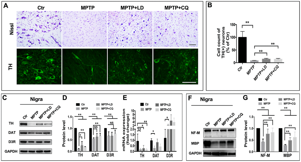 CQ improved the pathology of monkeys in the SN after MPTP intoxication. (A) Representative images of Nissl and immunofluorescence staining of TH (biomarkers of DA neurons) showed cell loss and cell atrophy in the SN after long-term of MPTP injection, and which were mitigated by both LD and CQ treatment. (B) Stereology analysis of cell count of DA neurons in the SN. (C, D) Western bolts and quantification showed increased protein expression of TH, DAT, and D3R in the SN of MPTP+LD and MPTP+CQ group in comparison to MPTP group. (E) Quantification showed the mRNA level of TH, DAT, and D3R in each group. (F, G) Western bolts and quantification showed increased protein expression of NF-M and MBP in the SN of MPTP+LD and MPTP+CQ group in comparison to MPTP group. Data expressed as the mean ± SD. *P**P