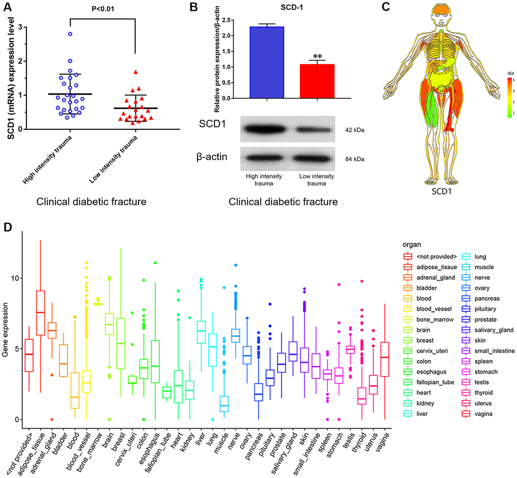 SCD1 expression in humans. (A) (mRNA) (B) (protein) showed the difference in SCD1 expression between patients with diabetic high-intensity fractures and patients with low-intensity fractures. (C, D) showed the human tissue enriched protein expression maps and the boxplot of SCD1 expression with high levels of SCD1 expression (GTEX cohort, n = 68).
