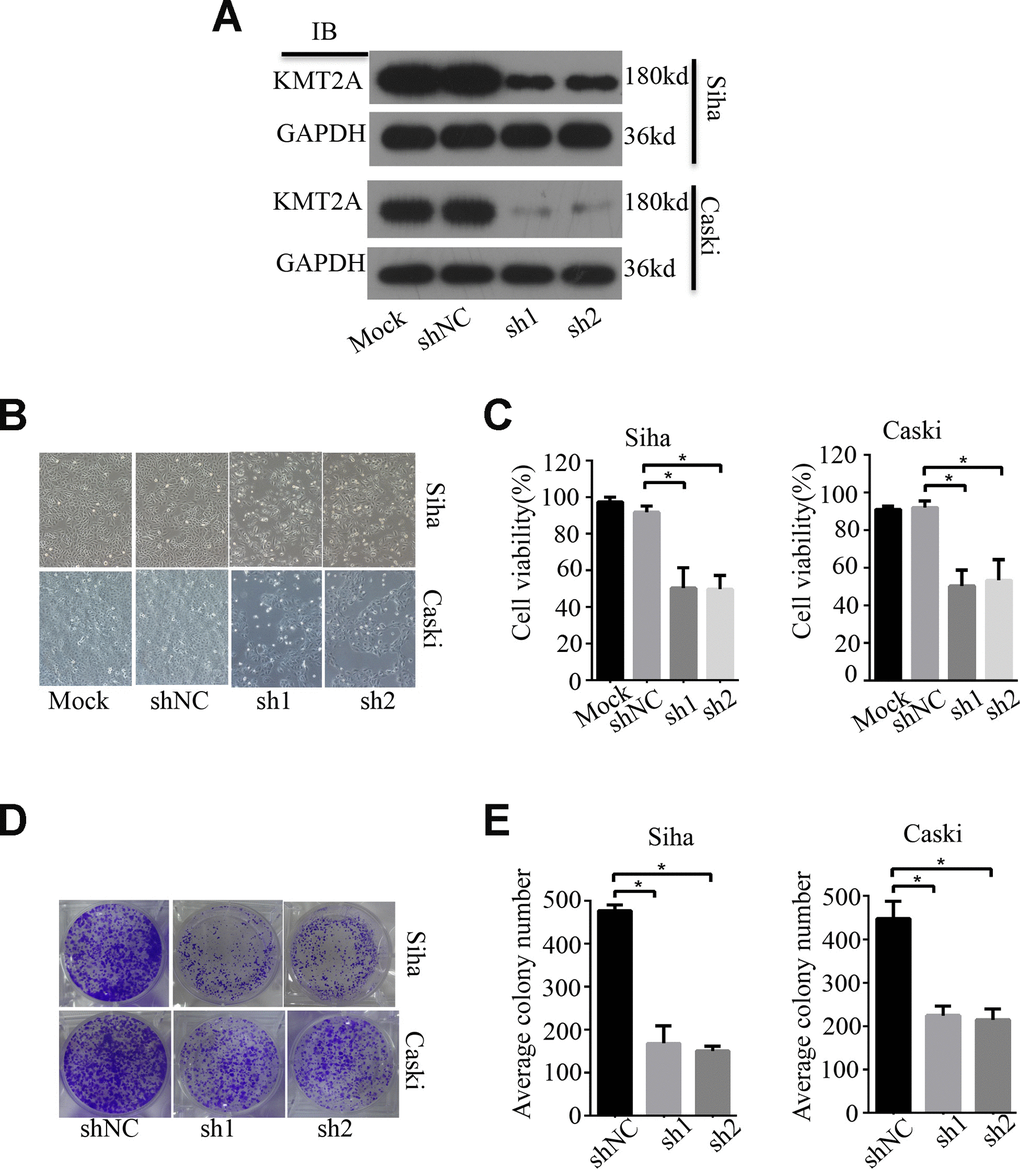 KMT2A Knockdown suppressed cell viability and colony formation in cervical cancer cells. (A) The protein levels of KMT2A in Siha and Caski cells were detected by Western blot. (B) The viability of Siha and Caski cells was measured by MTS assay. (C) The average cell viability %. (D) Colony formation of Siha and Caski cells. (E) The average value of colony number.