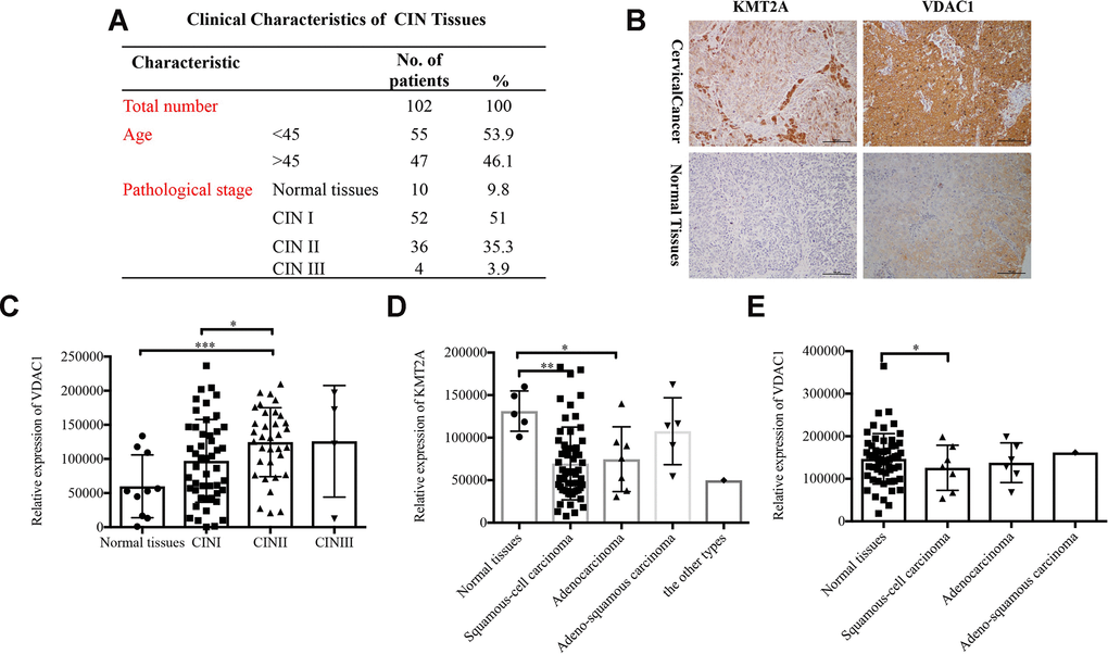 Expression of KMT2A and VADC1 was significantly correlated with cancer type in cervical cancer patients. (A) The clinical characteristics of cervical intraepithelial neoplasia. (B) Representative images of the immunohistochemical staining of KMT2A and VDAC1 in human normal and cervical cancer tissues. 400× magnification. (C) The correlation between the expression of VDAC1 and the stage of CIN in human cervical intraepithelial neoplasia tissues from 102 patients. (D) The correlation between the expression of KMT2A and different types of cervical cancer in human cervical cancer tissues from 48 patients. (E) The correlation between the expression of VDAC1 and different types of cervical cancer in human cervical cancer tissues from 48 patients.