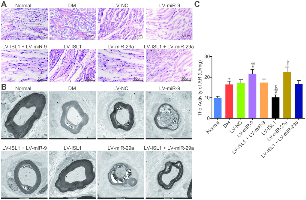 miR-9 and miR-29a aggravate the structural pathological changes of the sciatic nerves in rats with DM. (A) The sciatic nerves of normal rats and rats with DM following lentiviral infection detected by HE staining (× 200). (B) The sciatic nerve detection of normal rats and rats with DM following lentiviral infection examined by electron microscope (× 10000). (C) AR activity of sciatic nerve detection in normal rats and rats with DM following lentiviral infection; * p vs. the normal group; # p vs. the DM group; @ p vs. the LV-ISL1 + LV-miR-9 group; & p vs. the LV-ISL1 + LV-miR-29a group. Results were measurement data and expressed as mean ± standard deviation; one way analysis of variance was used to analyze data among multiple groups; n = 8; the experiment was repeated three times independently.