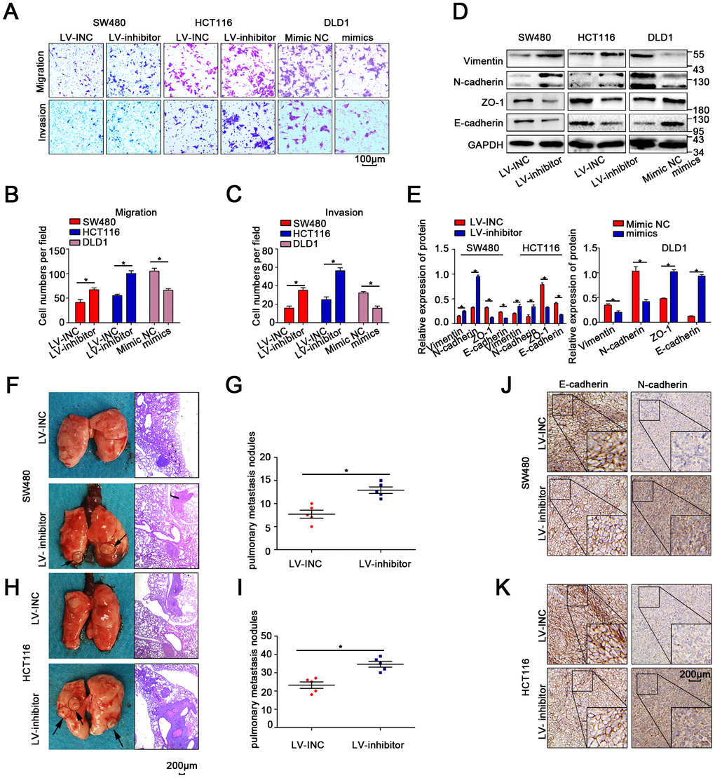 MiR-214-3p suppresses CRC cell metastasis in vitro and in vivo. (A–C) Transwell assays revealed that miR-214-3p suppressed CRC cell migration and invasion abilities. (D–E) Western blot analysis revealed that miR-214-3p decreased the expression of N-cadherin and vimentin and increased the expression of E-cadherin and Zo1. (F–I) More lung metastatic nodules were observed in the LV-miR-214-3p group than in the LV-INC group. (J–K) IHC analysis indicated that the expression of E-cadherin was lower and that the expression of N-cadherin was higher in xenograft subcutaneous tissues from the LV-miR-214-3p inhibitor group. The data are represented as the means±S.D. from at least three independent experiments. *p