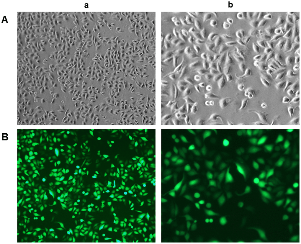 Characterisation and identification of rat liver sinusoidal endothelial cells (rLSECs) in vitro. (A) The morphology of rLSECs under white light. The cells grew by static adherence and the morphology of rLSECs were polygon or fusiform, resembling cobblestones under inverted microscopy. (B) Representative images of immunofluorescence staining of CD31 in rLSECs. Cells were stained with anti-CD31 antibodies. CD31 is uniformly expressed in rLSECs. Fluorescence images were acquired at an original magnification (green, CD31 expression). (a. ×100; b. ×200)