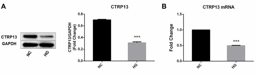The effect of high glucose on CTRP13 expression in rLSECs. rLSECs were treated with high glucose (25 mM) for 24 h. (A) Western blotting showing the expression levels of CTRP13 in the rLSECs treated by high glucose; (B) The mRNA expression levels of CTRP13 were detected using qRT-PCR analysis. The results were normalised to GAPDH mRNA levels. All data are representative as mean ± S.D. from three independent experiments. ***P 