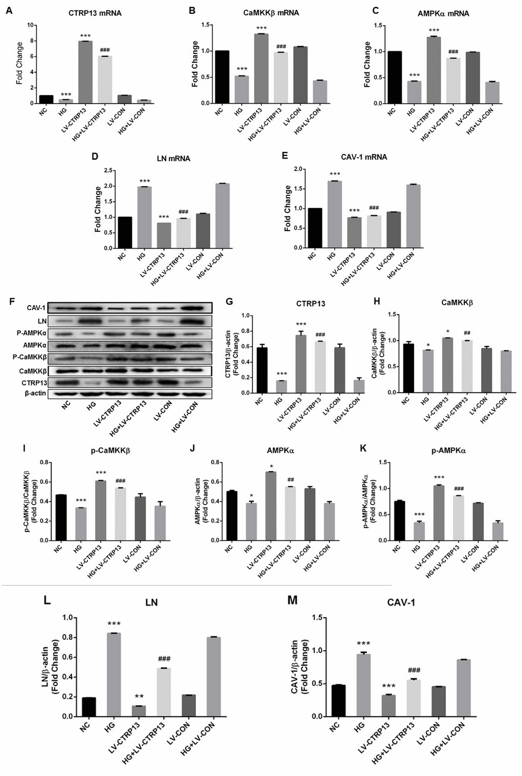 The effect of high glucose on the expression levels of CTRP13, p-CaMKKβ, CaMKKβ, p-AMPK, AMPK, LN and CAV-1 in rLSECs transfected by recombinant LV-CTRP13. (A) qRT-PCR analysis of CTRP13 mRNA. (B) qRT-PCR analysis of CaMKKβ mRNA. (C) qRT-PCR analysis of AMPKα mRNA. (D) qRT-PCR analysis of LN mRNA. (E) qRT-PCR analysis of CAV-1 mRNA. (A–E) The results were normalised to β-actin mRNA levels. (F) The protein expression levels of each group were detected using western blotting, and β-actin was used as a loading control. (G) Western blotting results showing relative CTRP13 expression. (H) Western blotting results showing relative CaMKKβ expression. (I) Western blotting results showing relative phos-CaMKKβ expression of CaMKKβ activation. (J) Western blotting results showing relative AMPKα expression. (K) Western blotting results showing relative phos-AMPKα expression of AMPKα activation. (L) Western blotting results showing relative LN expression. (M) Western blotting results showing relative CAV-1 expression. (F–M) β-actin (42 kDa) represents the loading control. All results are expressed as mean±S.D. from three independent experiments, *P **P ***P ##P ###P 