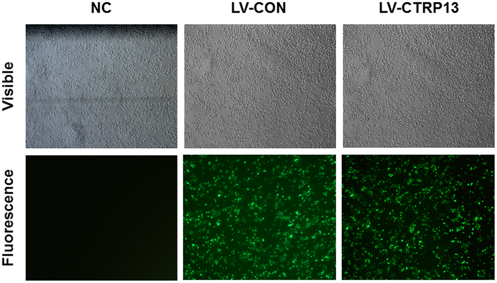 Lentiviral transfection of rLSECs. The infection rate of LV-CTRP13 and LV-CON in the rLSECs at an MOI of 100 were observed under a fluorescence microscope at 72 h following infection, respectively (×40).