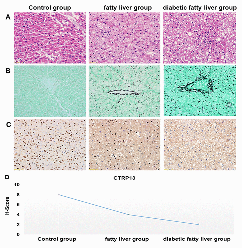 Histopathological features of the liver tissues. (A) Representative images of HE staining in livers from different groups of rats (× 40). HE staining was utilized to analyze histological abnormalities. (B) Representative images of the gomori methenaminutese silver staining in liver sections from different groups of rats (×40). (C) Representative images of immunohistochemistry staining of CTRP13 in livers from different groups of rats (× 40). (D) Quantification of CTRP13-positive cells in liver sections from different groups of rats.