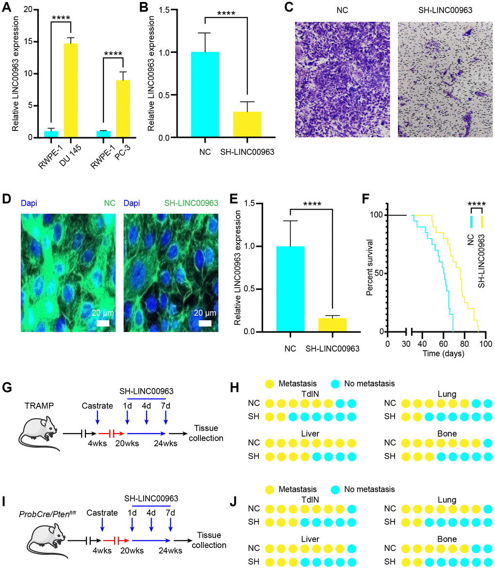 Effects of noncoding RNA LINC00963 on PCa cell metastasis in vitro and in vivo. (A) RT-qPCR analysis of LINC00963 expression in the PCa cell lines DU 145 and PC-3 compared to that of the normal prostate cell line RWPE-1. (B) LINC00963 expression in SH-LINC00963 Lentivirus and empty lentivirus vector–treated DU145 cells was tested using RT-qPCR. (C) Transwell invasion assays were performed to determine the invasion of SH-LINC00963 Lentivirus–transfected or empty lentivirus vector–transfected DU 145 cells. (D) A representative of the fluorescence image of LINC00963-GFP expression (green) and DAPI (blue) in SH-LINC00963 lentivirus–infected prostate of PCa mice. Scale bars = 20 μm. (E) RT-qPCR analysis of LINC00963 expression in SH-LINC00963 Lentivirus–transfected or empty lentivirus vector–transfected PCa tissues. (F) Survival time of PCa mice injected with SH-LINC00963 Lentivirus or empty lentivirus vector. (G) Experimental approach to knock down LINC00963 in castrated TRAMP mice. (H) Incidence of TdLN, liver, lung, and bone metastases following injection with SH-LINC00963 Lentivirus or empty lentivirus vector in castrated TRAMP mice (n = 10, every group). (I) The experimental approach to knock down LINC00963 in castrated ProbCre/Ptenfl/fl mice. (J) Incidence of TdLN, liver, lung, and bone metastases following injection with SH-LINC00963 Lentivirus or empty lentivirus vector in castrated ProbCre/Ptenfl/fl mice (n = 10, every group). Mean ± SEM, ****P 