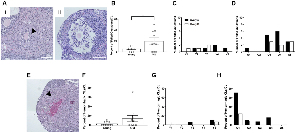 Reproductively old mice exhibit more failed ovulation events. (A) Representative H&E-stained ovarian tissue sections depicting two phenotypes indicative of failed ovulation events including (I) trapped oocytes within CLs and (II) expanded unruptured antral follicles. Scale bars are 100 μm. (B) Graph showing the percent of failed ovulations per CL number for reproductively young and old mice (N = 10 ovaries per age group). A t-test was performed and P = 0.025. Data are represented as mean ± SEM. The number of failed ovulations per ovary for all (C) reproductively young and (D) reproductively old mice. (E) Representative H&E-stained ovarian tissue section depicting a hemorrhagic CL. The scale bar is 50 μm. (F) Graph showing the percent of hemorrhagic CLs for both age cohorts (N = 10 ovaries per age group). A t-test was performed and there was no significant difference (P > 0.05). Data are represented as mean ± SEM. The percent of hemorrhagic CLs for all (G) reproductively young and (H) reproductively old mice.