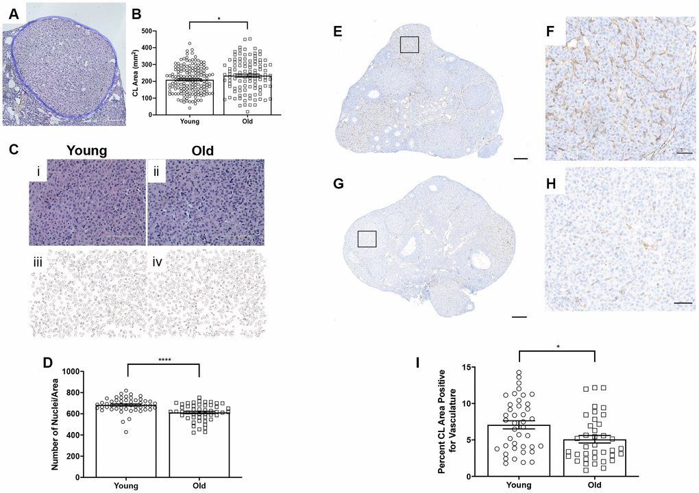 CLs exhibit age-associated structural differences. (A) Representative H&E-stained CL. The perimeter of the CL is outlined in blue. The scale bar is 50 μm. (B) Graph showing the area of each CL. Each data point corresponds to one CL. A t-test was performed; asterisk indicates significance (P = 0.022). (C) Images showing how luteinized area was determined at 40X magnification and the same images in ImageJ software. (D) Graph showing the average number of nuclei per defined CL area. Each data point corresponds to one CL. A t-test was performed; asterisks denote P E) Representative image of CD31 staining in reproductively young ovarian tissue with the boxed region in (F) and (G) representative image of CD31 staining in reproductively old ovarian tissue with the boxed region in (H). (I) Graph showing the percent of CL area positive for vasculature. A t-test was performed (P = 0.01). Scale bars are (E, G) 200 μm and (F, H) 50 μm. Data are represented as mean ± SEM.